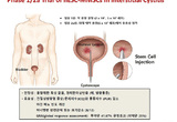 줄기세포로 난치병 ‘간질성방광염’ 임상시험 세계 첫 성공